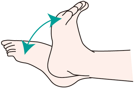 再発しやすい足首の捻挫に効果的なリハビリトレーニングの方法【症例】